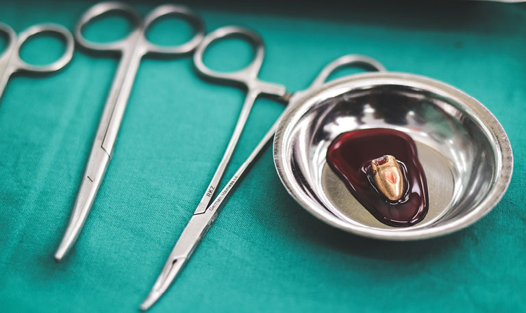 A bullet in blood on a surgical tray in an operating room