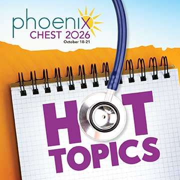 Hot Topics displayed on a notebook