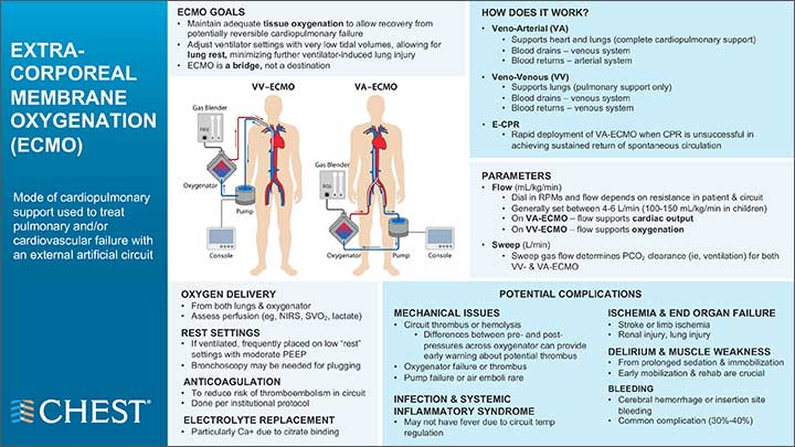 Noninvasive Ventilation infographic