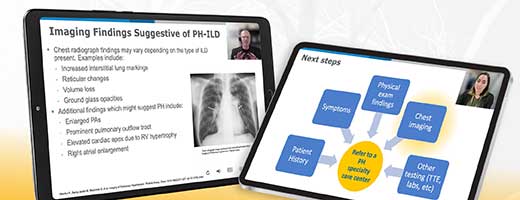 Radiological Signs and Symptoms of PH-ILD video displayed on a computer and tablet screen