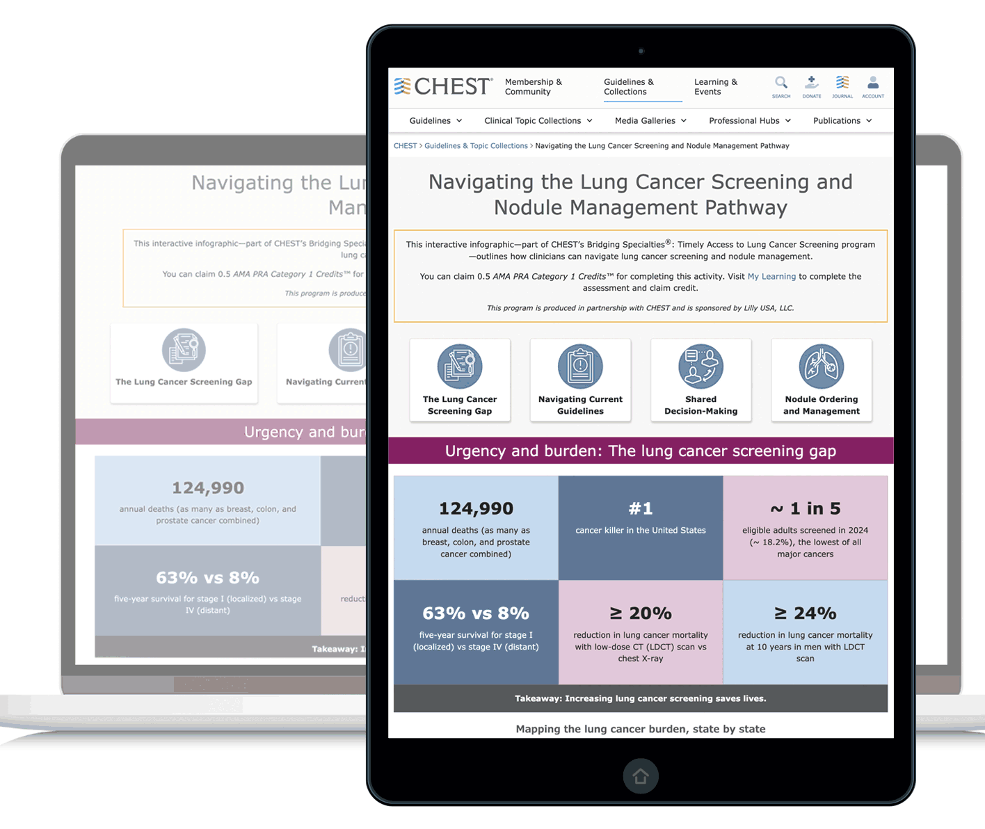 Navigating the Lung Cancer Screening and Nodule Management Pathway inforgraphic pdf